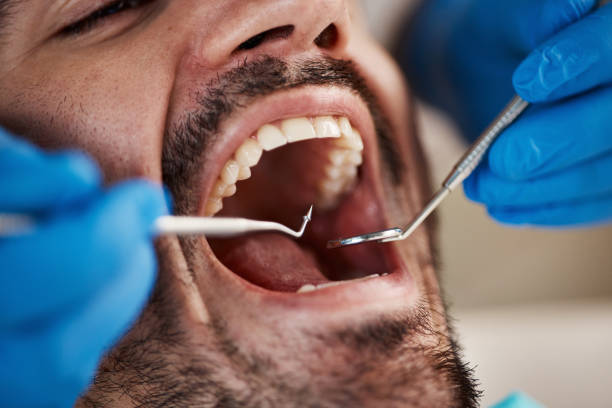 Best Emergency Denture Repair in Elwood, IN