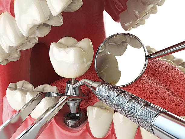 Best Emergency Dental Care for Sports Injuries in Elwood, IN